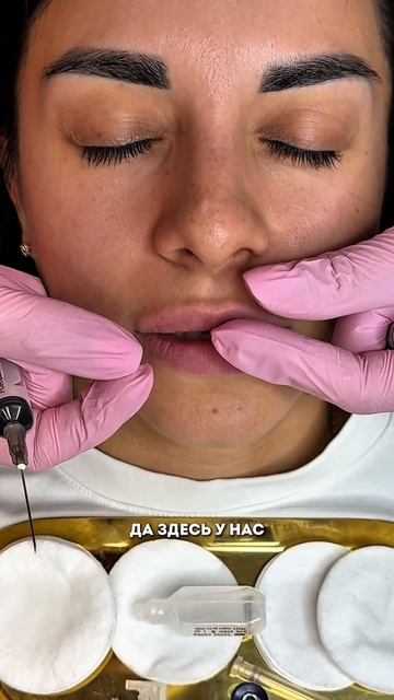 Растворение губ без риска аллергии