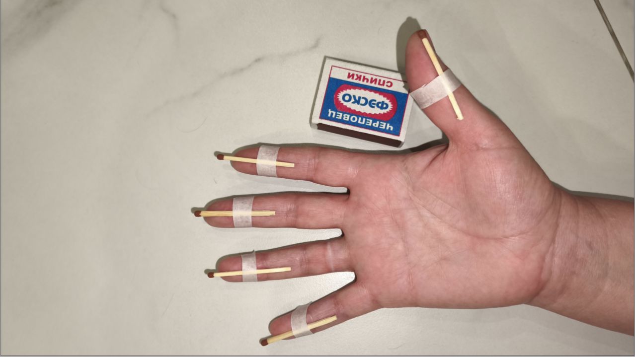 Руки и суставы перестанут болеть. Используйте ветки этого дерево или обычные спички смотреть онлайн