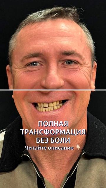 Трансформация за 1 день