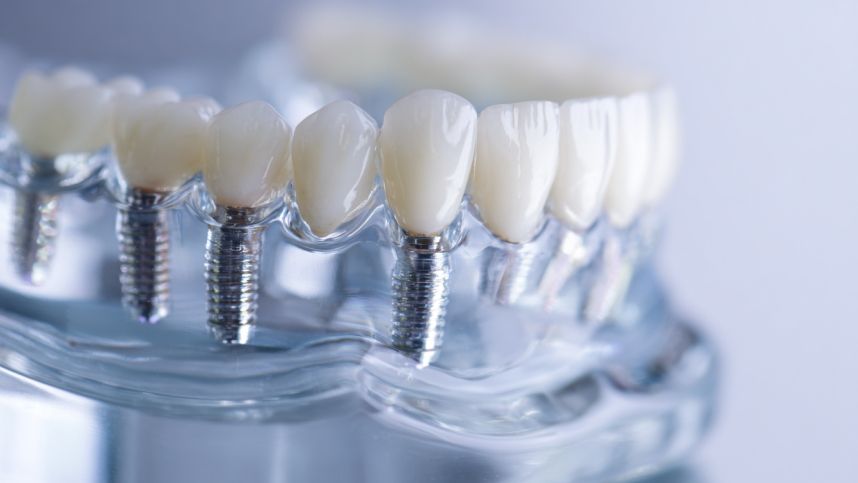 Стоматология на кухне: опасные товары для лечения зубов заполонили маркетплейсы смотреть онлайн