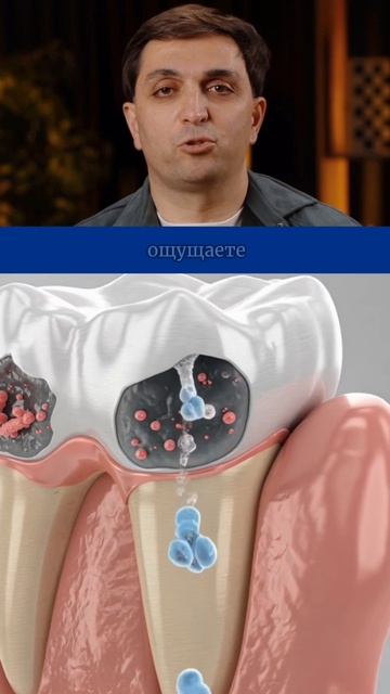 Боль в зубе