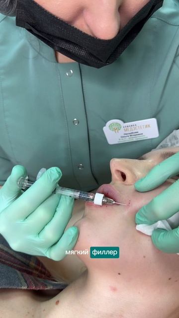 Коррекция морщин нижней трети лица смотреть онлайн