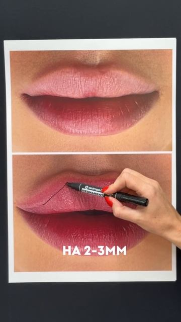 Я перехожу на пики