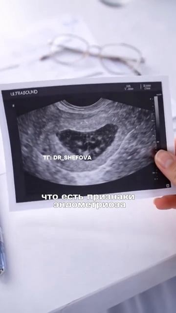 Как по УЗИ понять что есть эндометриоз