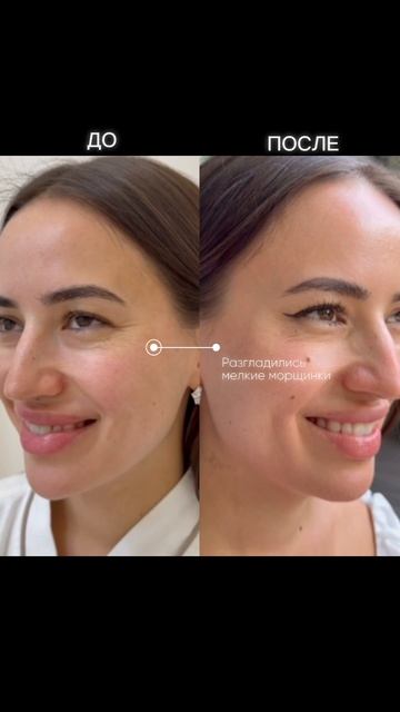 Пока кожа молодая — косметолог не нужен?