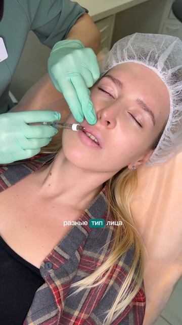 Контурная пластика губ смотреть онлайн