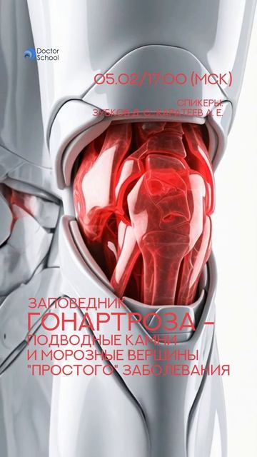 Гонартроз — больше, чем просто "износ сустава". ⚠️