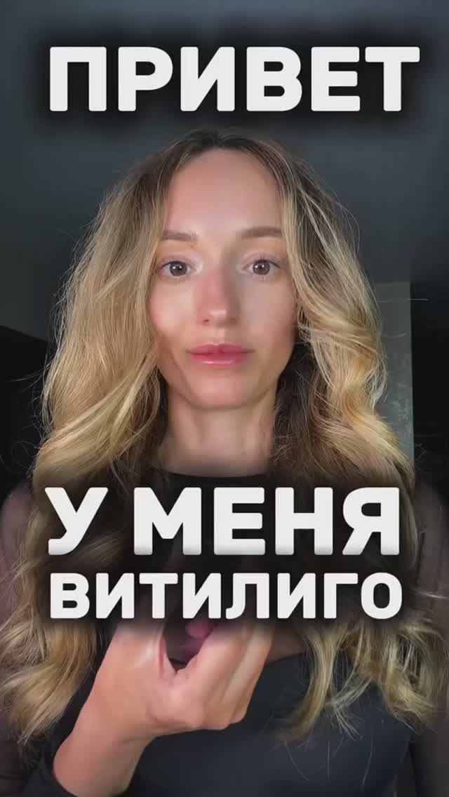 У МЕНЯ ВИТИЛИГО И Я РЕШИЛА СТАТЬ НУТРИЦИОЛОГОМ, ЧТОБЫ ПОБЕДИТЬ АУТОИММУНКУ