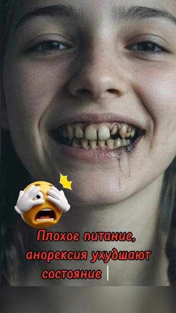 Плохое питание, анорексия