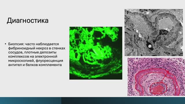 Гиперчувствительности — Часть 3 (Блок 5. Лекция 2) Гиперчувствительности — Часть 3 (Блок 5. Лекция 2)