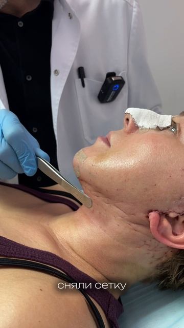 Для чего нужна гемостатическая сетка?