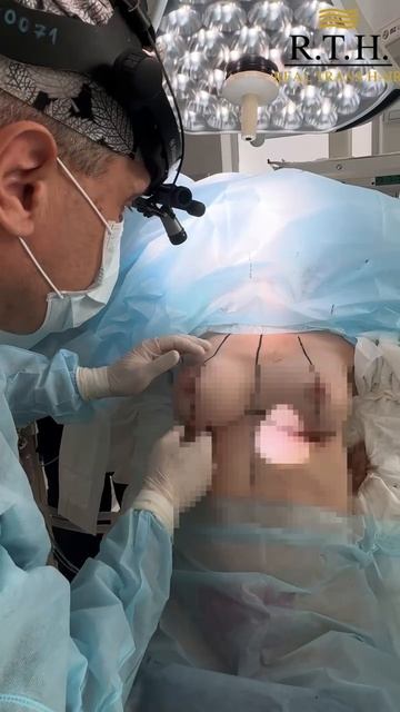 Маммопластика