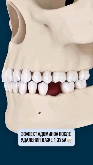 Эффект домино