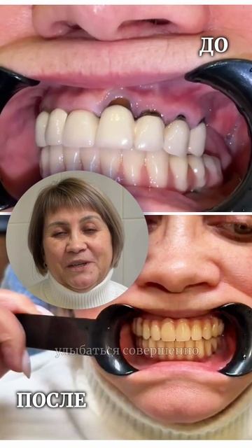 К нам часто приходят пациенты, которые уже через это проходили