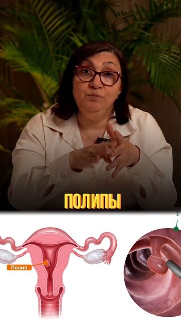 Не игнорируй Кандиду! Пройди экспресс-тест на степень поражения организма. Ссылка в шапке профиля ⬆️