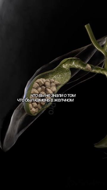 Болит печень?Хочешь восстановить организм? Забирай 3 закрытые лекции. Ссылка в шапке профиля смотреть онлайн