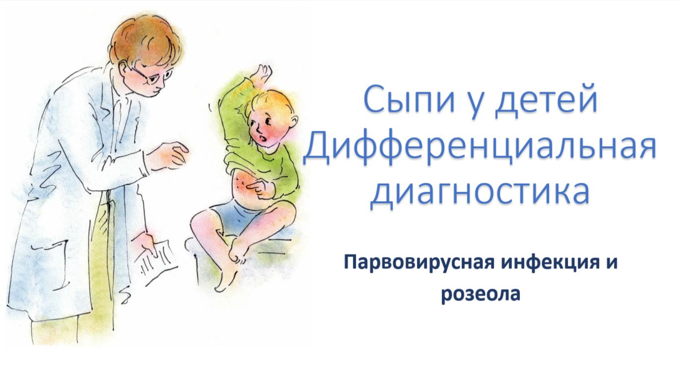 Парвовирусная инфекция и розеола смотреть онлайн