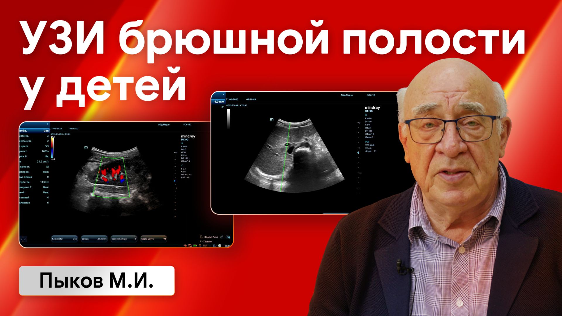 УЗИ органов брюшной полости у детей: практический мастер-класс с Пыковым М.И. смотреть онлайн