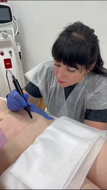 Обучение на аппарате холодной плазмы Plazobest SUPERAN