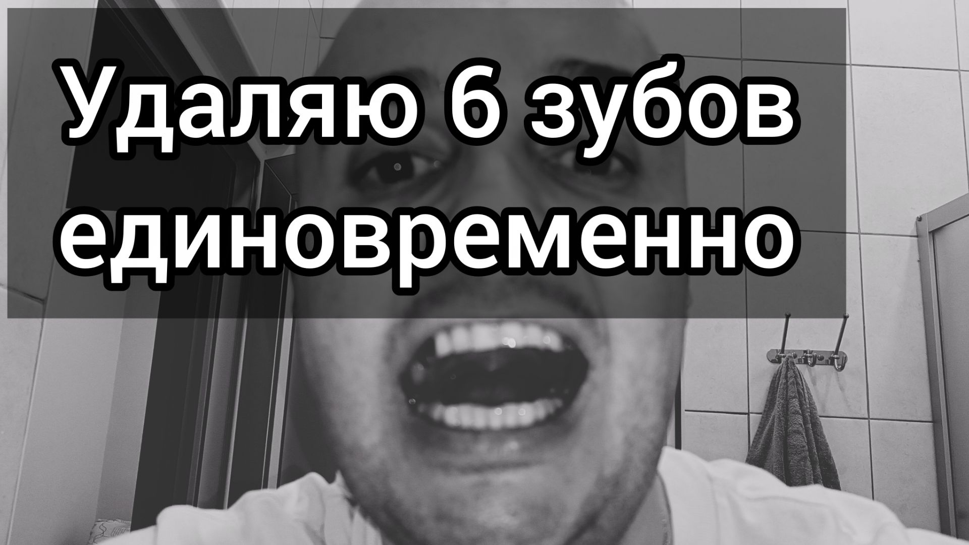Удаляю 6 зубов единовременно. Можно ли так делать?