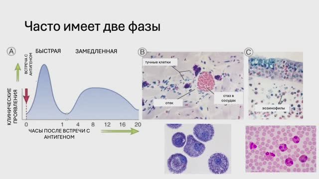 Гиперчувствительности — Часть 1 (Блок 5. Лекция 2) Гиперчувствительности — Часть 1 (Блок 5. Лекция 2)