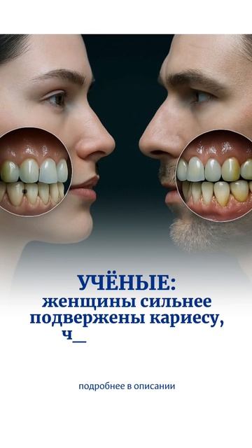 Факт — женщины больше подвержены кариесу.