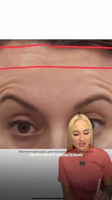 Заломы над бровями после ботокса
