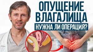 Опущение органов можно ОСТАНОВИТЬ! / Признаки опущения матки и УПРАЖНЕНИЕ, которое помогает всем!