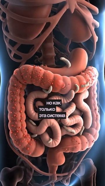 Чешется попа? Это не аллергия смотреть онлайн