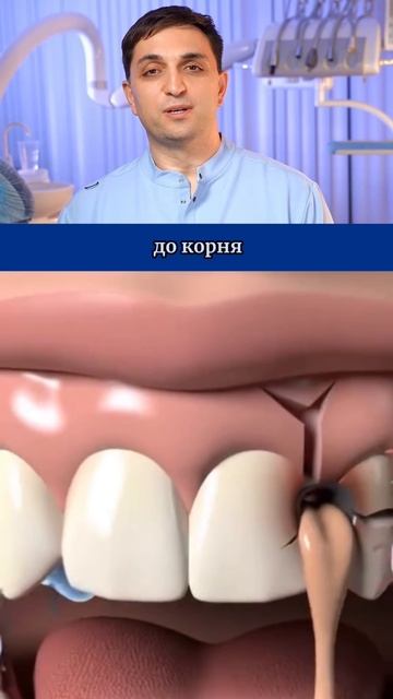 К чему может привести зубной абсцесс