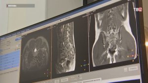 В НИИ ревматологии наладили помощь пациентам с редким аутоиммунным заболеванием