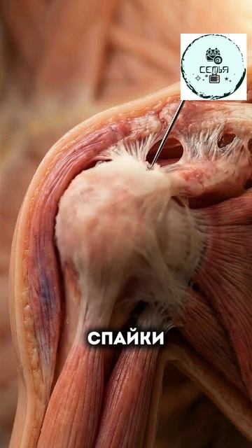 СНЯТЬ ВОСПАЛЕНИЕ В ПЛЕЧЕВОМ СУСТАВЕ С ПОМОЩЬЮ ИГЛЫ