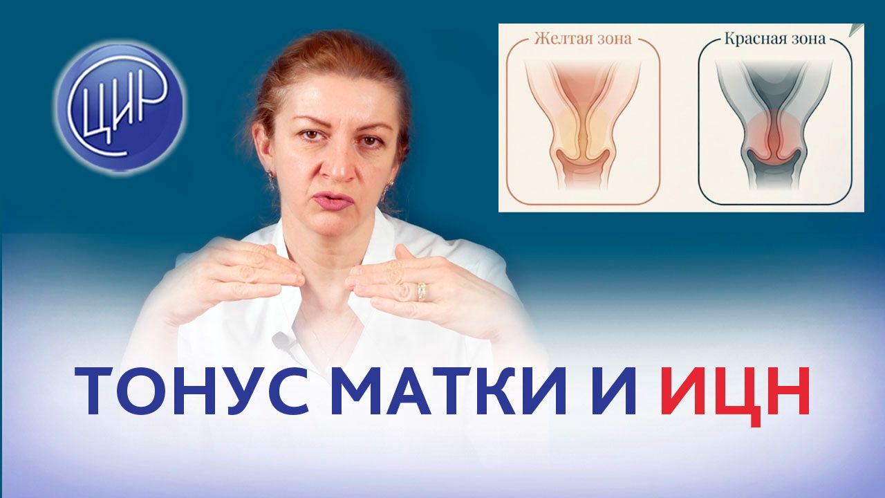 Тонус матки и истмико-цервикальная недостаточность. Дементьева С.Н. смотреть онлайн