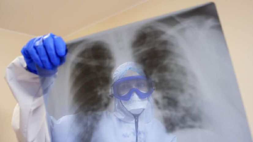 Вирусолог предупредила о тяжелых осложнениях при оспе обезьян смотреть онлайн