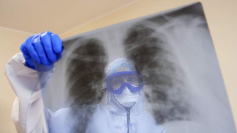 Вирусолог предупредила о тяжелых осложнениях при оспе обезьян Вирусолог предупредила о тяжелых осложнениях при оспе обезьян