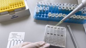 Вирусолог Компанец: оспа обезьян у человека может вести к энцефалиту