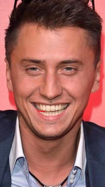 -6455554725693822837