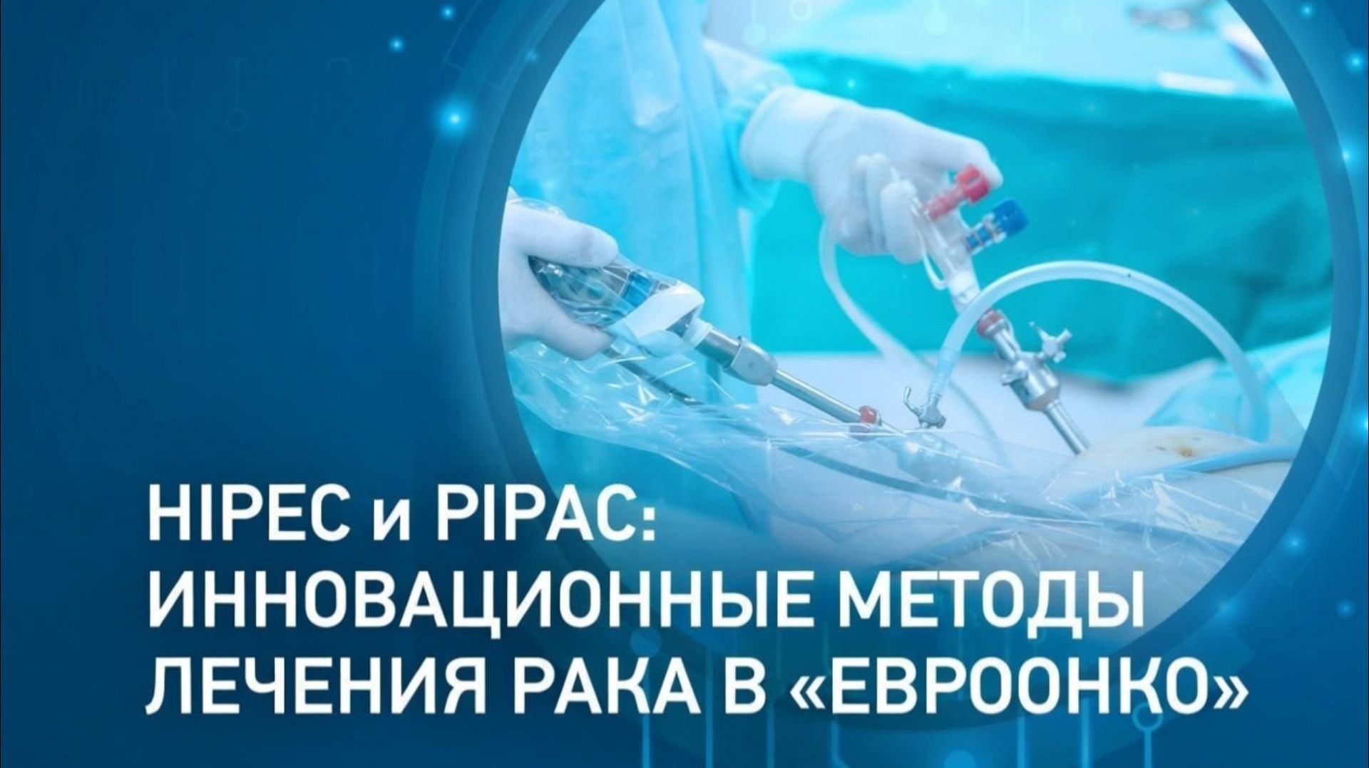 Главный врач Евроонко Андрей Пылёв - об инновационных методах лечения канцероматоза брюшины