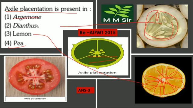 #neetexam question смотреть онлайн