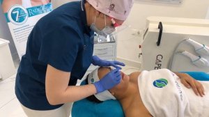 Дерматологический пилинг Enerpeel