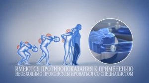 Мильгамма