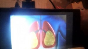 Реклама Бромгексин Берлин-Хеми