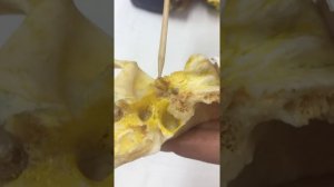 Височная кость. Каналы височной кости.