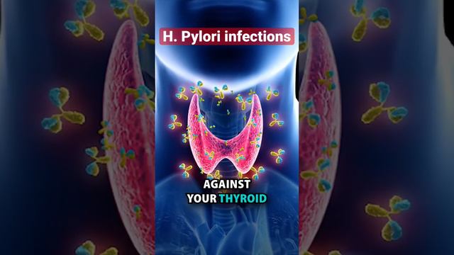 H. Pylori infection can cause autoimmune disease like rheumatoid arthritis, and hypothyroidism!