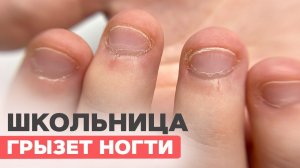 Сгрызла ногти | Маникюр для школьницы