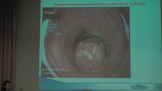03 А А  Владимирова – Осложнения колоноскопии