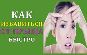 Как быстро избавиться от прыща на лице.