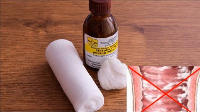 Молочница у грудничков: пути передачи, причины возникновения, симптомы и лечение смотреть онлайн