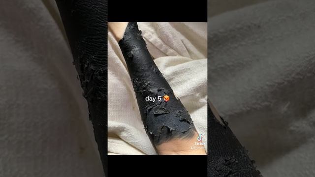 Healing on my blackout sleeve Video By reillysark #Shorts смотреть онлайн