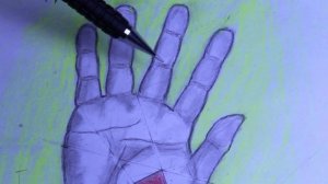 Разрезы при панарициях